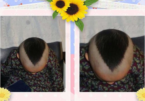 бôڼͷͼƬ ͯķͲÿ
